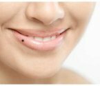 Особенности и причины появления родинки на губе: верхней и нижней